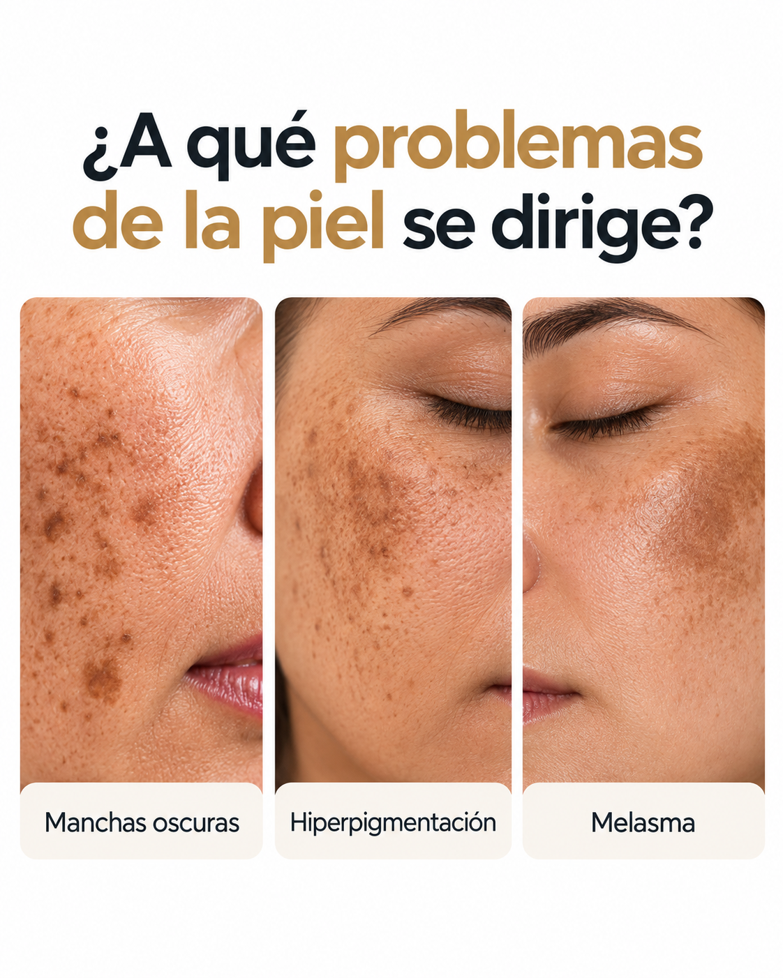 Corrector de Manchas Oscuras Nuvane, con Ácido Azelaico 20g