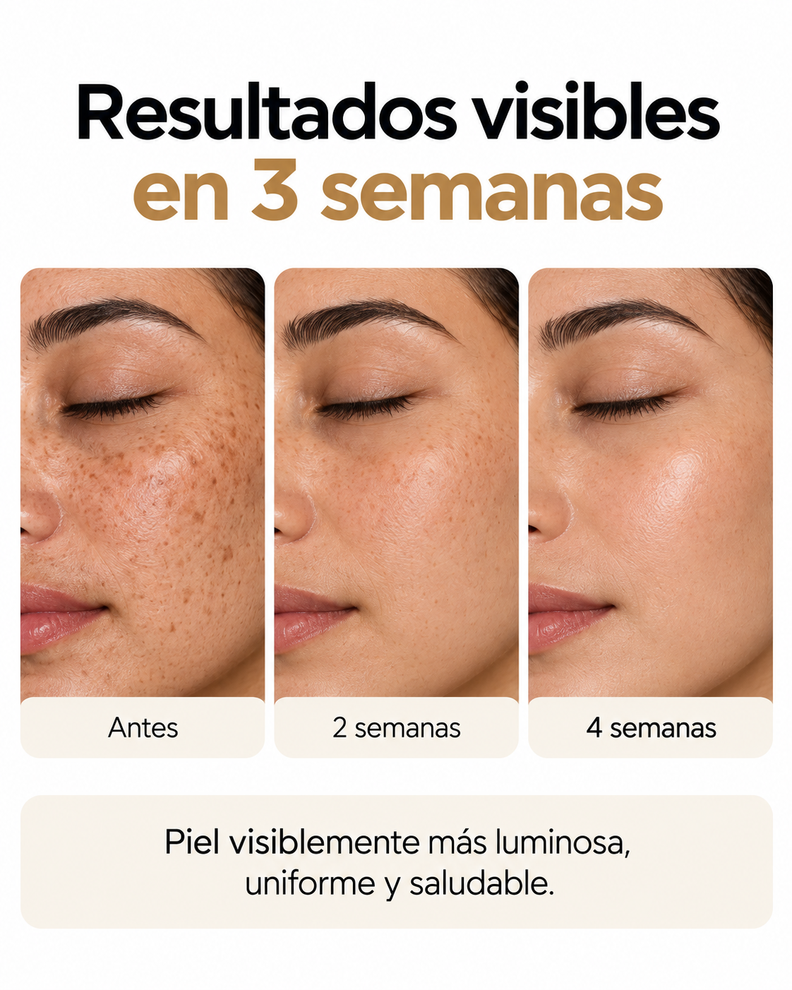 Corrector de Manchas Oscuras Nuvane, con Ácido Azelaico 20g